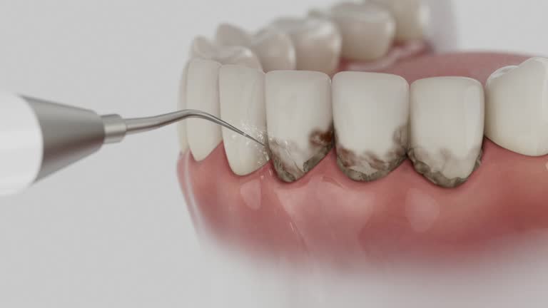 Reliable Dental contractor in Effort, PA by Dentist Open Now